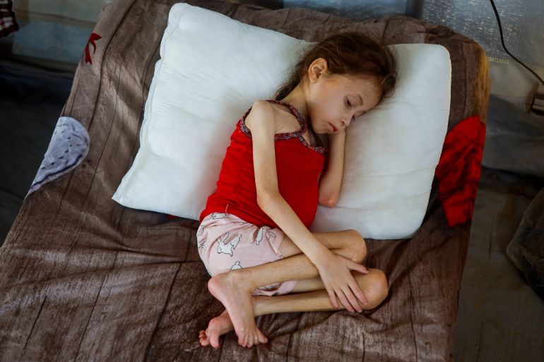 FILE PHOTO: Jana Ayad, a malnourished Palestinian girl, rests on a bed as she receives treatment at the International Medical Corps field hospital, amid the Israel-Hamas conflict, in Deir Al-Balah in the southern Gaza Strip, June 22, 2024. REUTERS/Mohammed Salem/File Photo